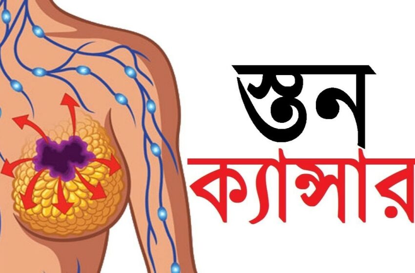  স্তন ক্যান্সার চিহ্নিতকরণের মেশিন পড়ে থাকলেও চালু হয়নি